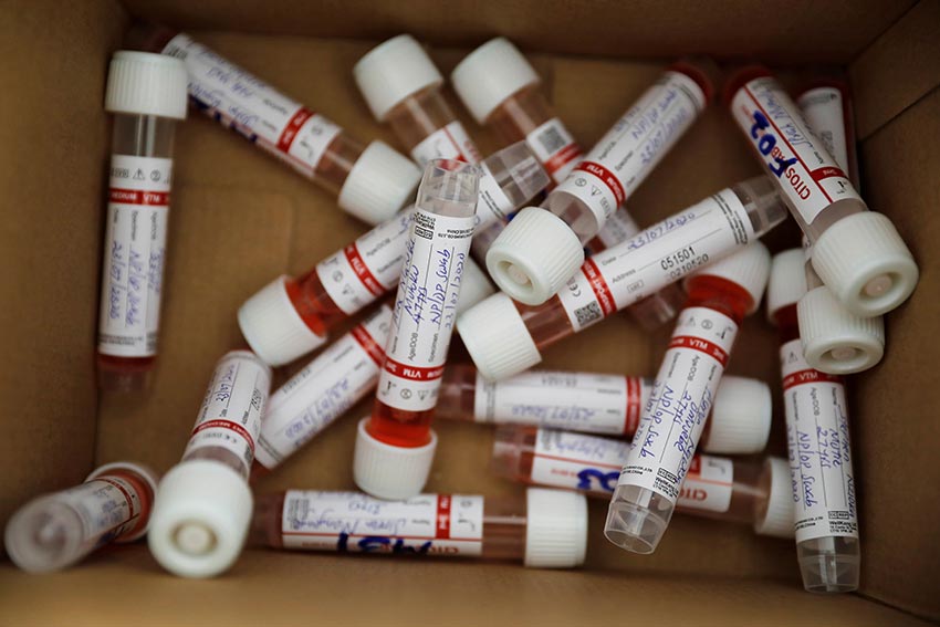 Tubes containing COVID-19 tests inside a field hospital built in a soccer stadium in Machakos, Kenya, in July 2020. Africa’s testing capacity is among the lowest in the world, as wealthier nations can afford to pay more for kits.